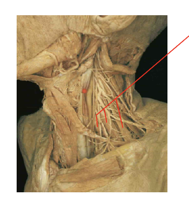<p>What is this muscle: What is its origin. Where does it inserts. </p>