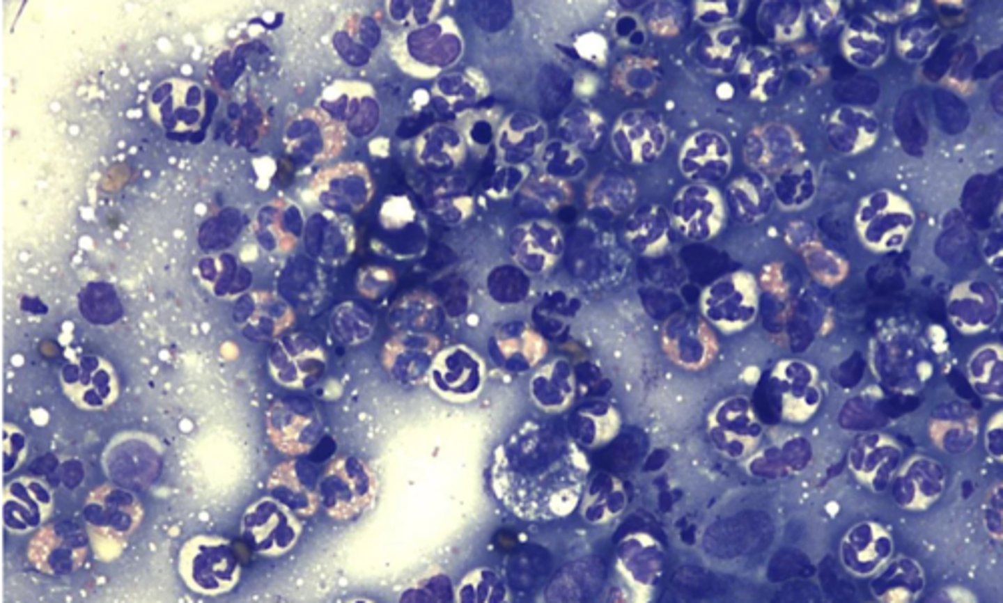 <p>What type of inflammation is this?</p>