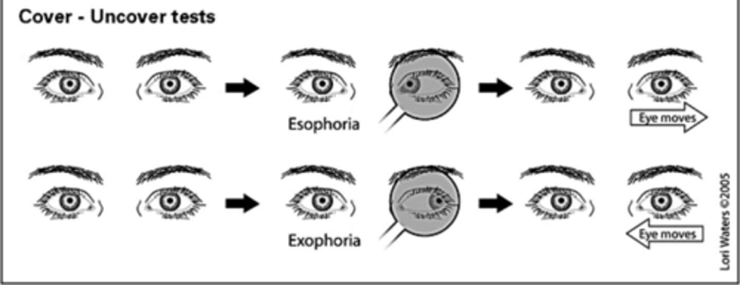 <p>Inward (phorias are latent or transient)</p>