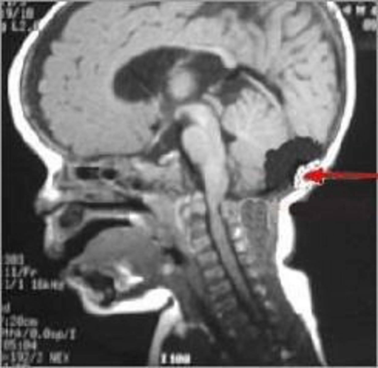 <p>Magnetic imaging for detailed brain examination.</p>