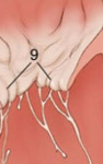 <p>Chordae tendinae</p>
