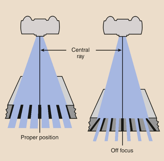 <ul><li><p>occurs when the <span>incorrect SID (focal range) is applied to a focused grid causing major grid cut-off</span></p></li><li><p><span>ensure correct focal range is applied </span></p></li></ul><p></p>