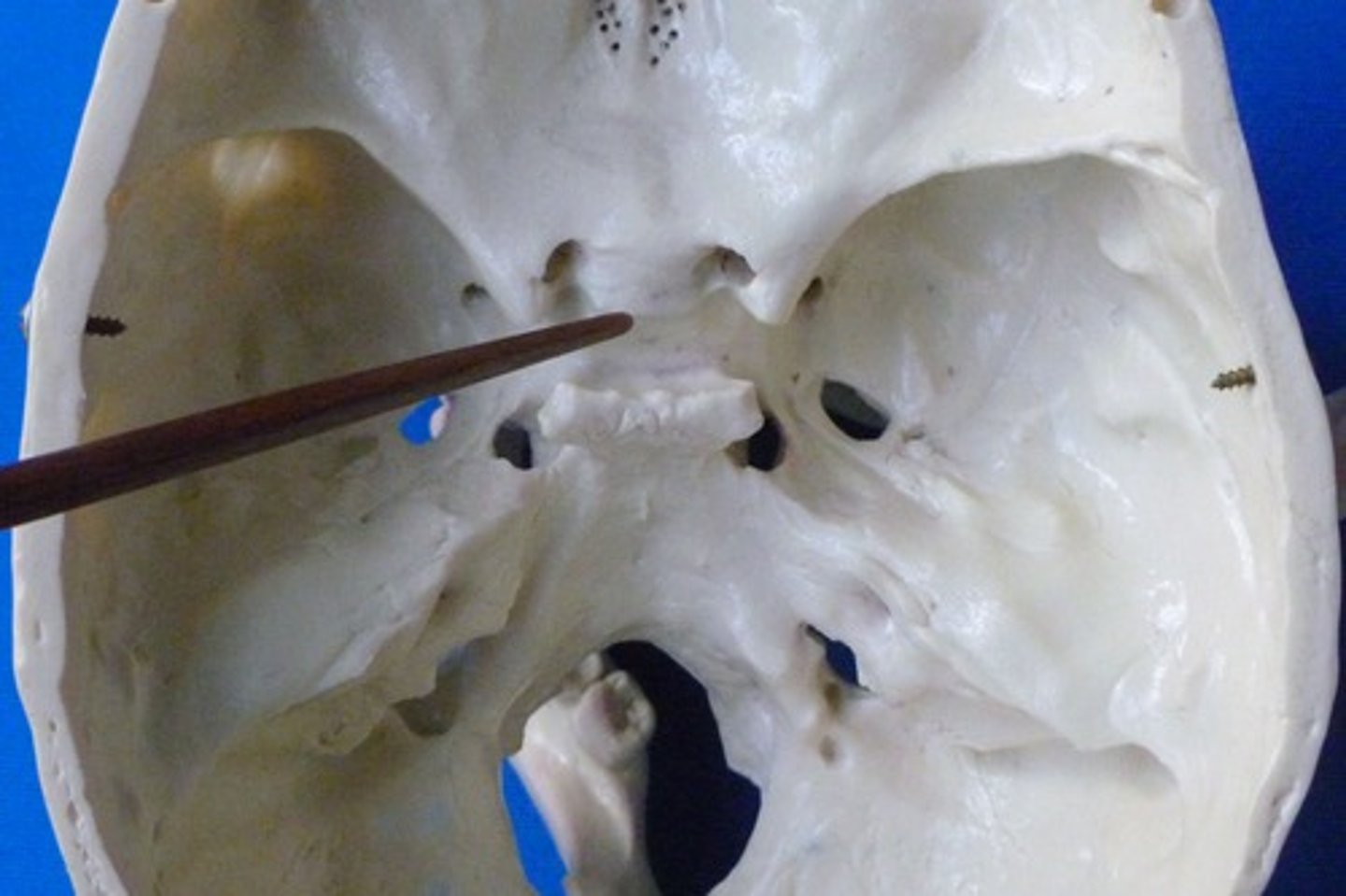 <p>"turkish saddle" grove in body of sphenoid</p>