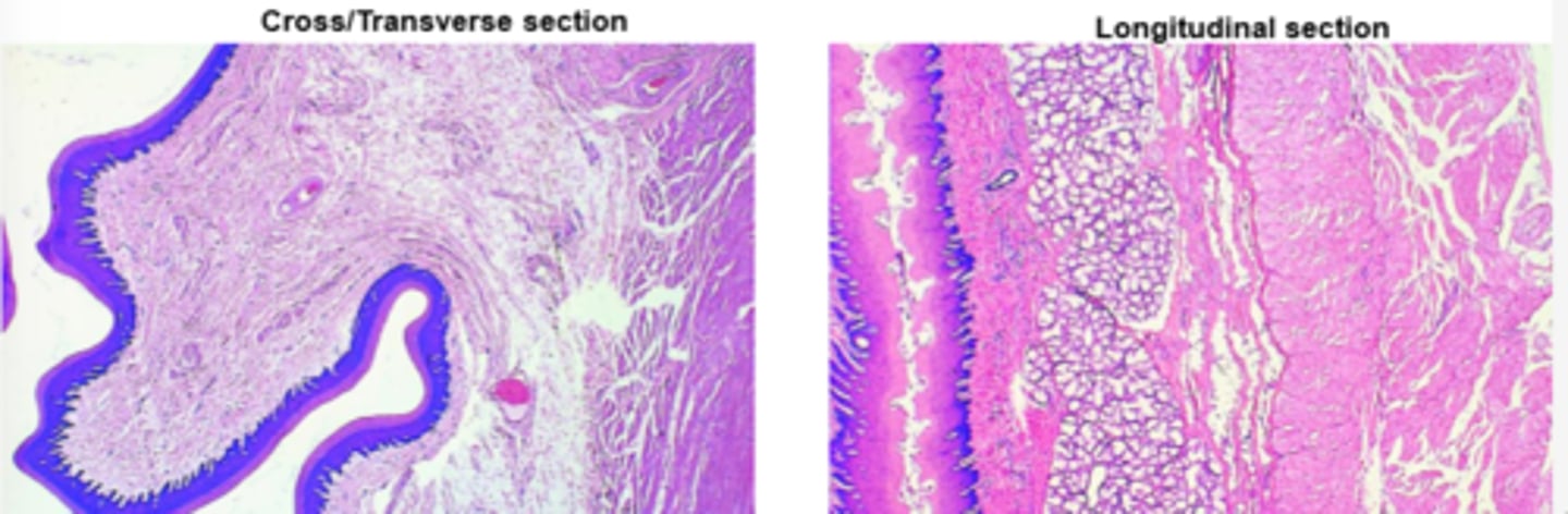 <p>Esophagus:</p><p>epithelium of horse and pig</p>