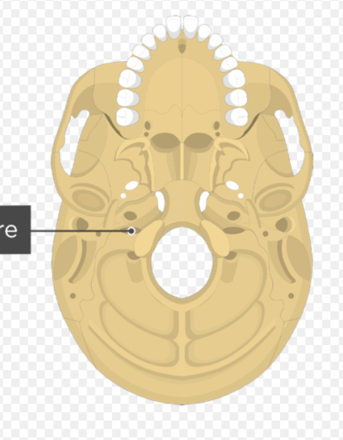 <p>What part of the skull is this?</p>