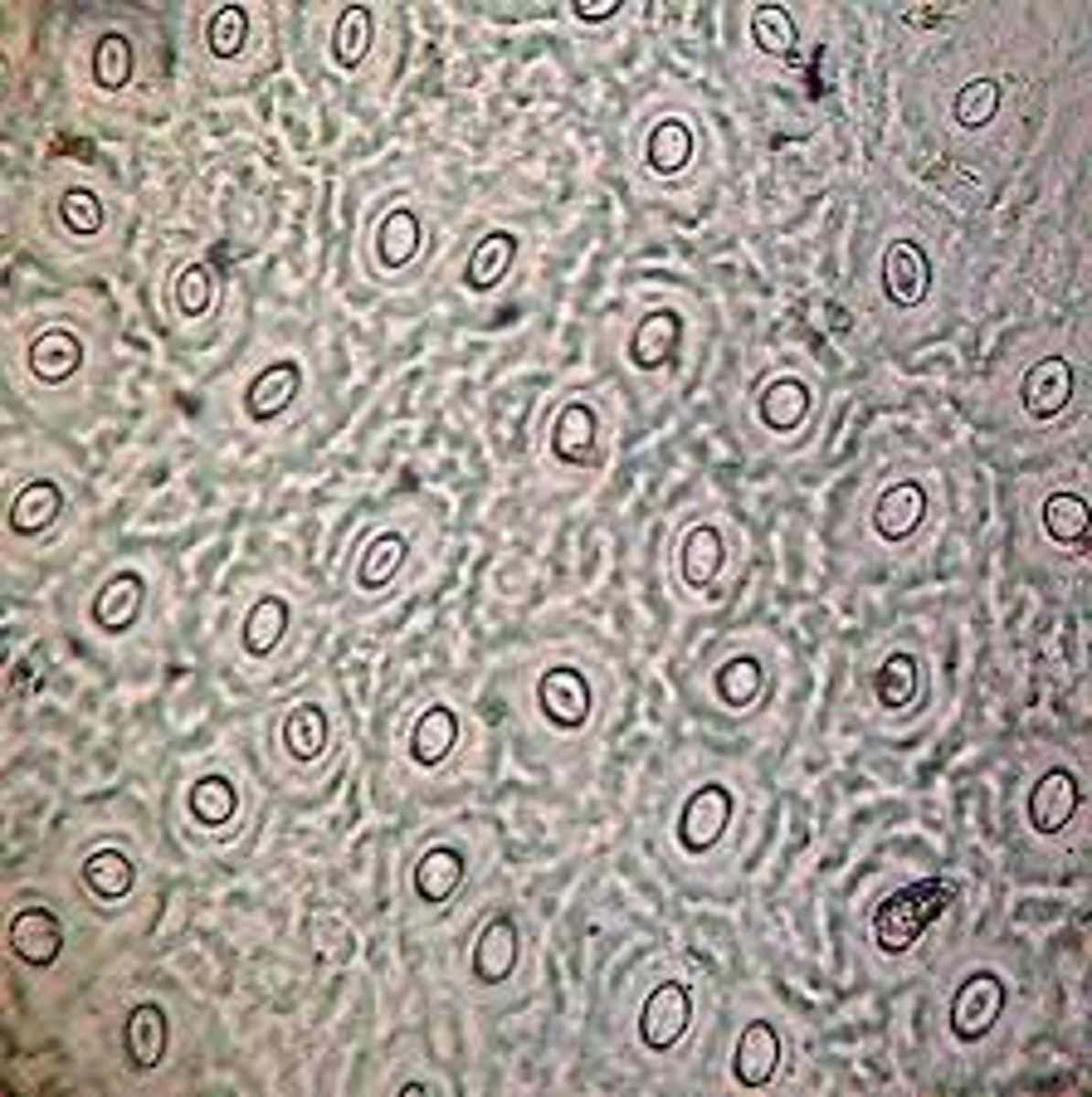 <p>GOAL: Observe the differences in stomatal activity of leaves subjected in light and dark treatments</p><p>0) Dark treatment plants have been placed in darkness for >24 hours.</p><p>1) Remove a leaf from the plant. Prepare a cast of the underside of a leaf surface by painting a thin layer of clear fingernail polish</p><p>2) Let dry for 10 mins</p><p>3) Take a clear piece of tape and firmly press it on the nail polish. When you peel the tape, it should remove the cloudy leaf cast</p><p>4) Tape the peeled impression to the DARK labeled slide, trip any excess</p><p>5) Examine the leaf cast under the light microscope, focusing on low power, then 100x power</p><p>6) Search for areas with concentrated stomata, move to 400x power</p><p>7) Record data and count number of stomata</p><p>8) Use the fine focus to determine if stomata are open and closed. Open stomata will appear rounder, while closed stomata resemble flat footballs</p><p>9) Repeat for other microscope fields</p><p>10) Follow the same procedure to test the plants that have been in the light for at least 30 minutes</p>