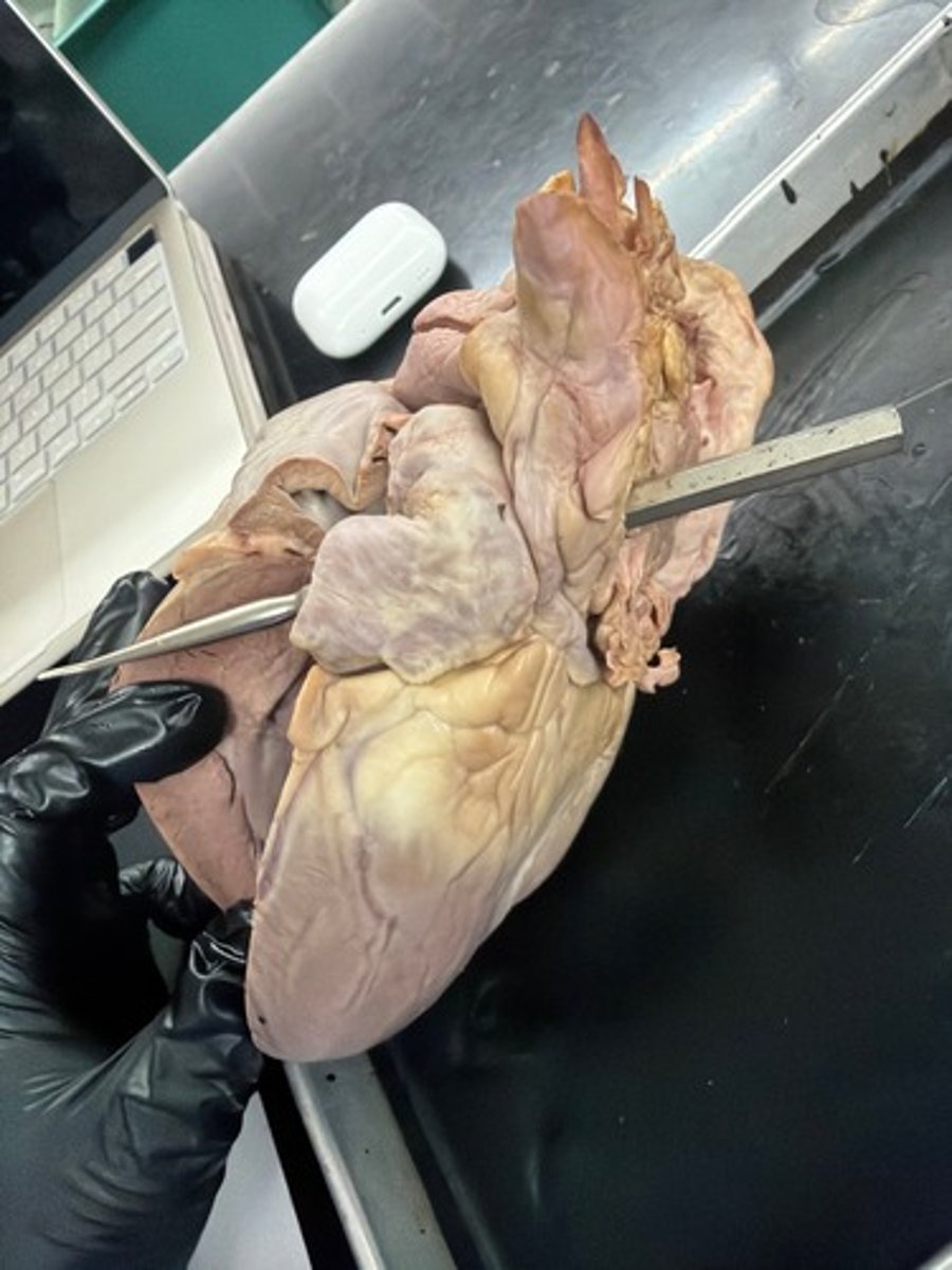 <p>goes to bi side</p>