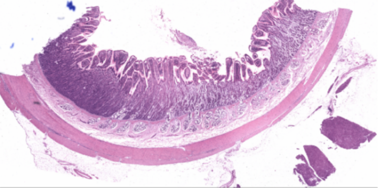 <p>What organ specimen is shown in this slide?</p>