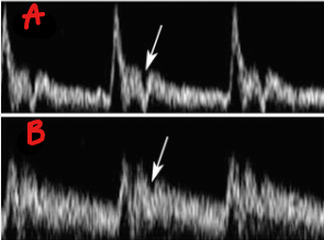 <p>Identify this image. </p>