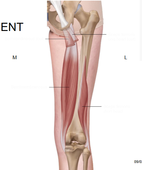 <p>Label the hamstrings </p>