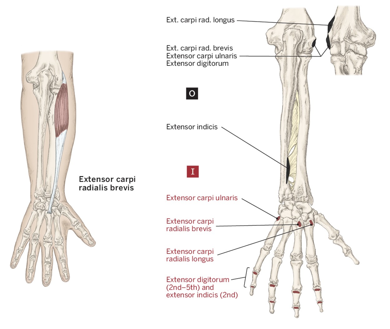 <p>O- Lateral Epicondyle of the humerus</p><p>I- (Posterior) Base of the 2nd &amp; 3rd metacarpals</p><p>A- Wrist extension &amp; Radial deviation</p>