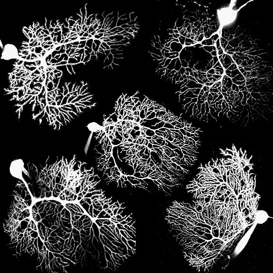 <p>cells in the cerebellum</p>