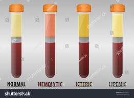 <p>high concentration of <strong>triacylglycerols (TAGs) </strong></p><p>cloudy sample</p><p>reduces transmission of light, interferes with spectrophotometric tests</p>
