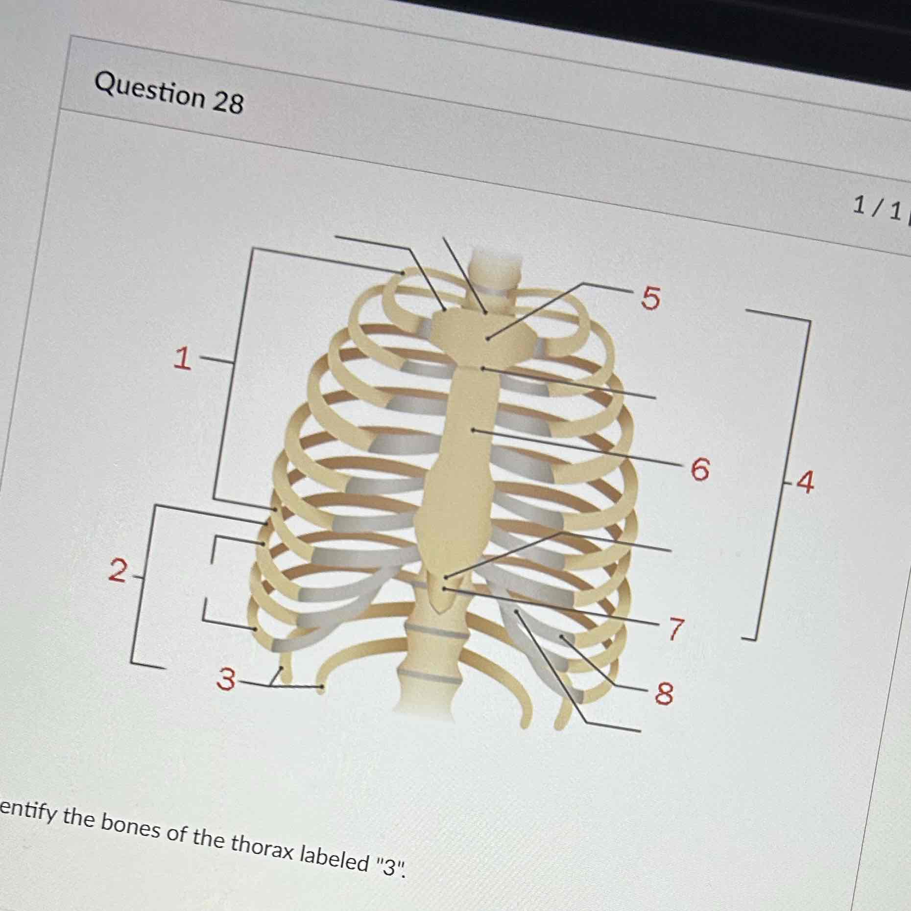 <p>Identify the bones of the thorax labeled 3 </p>