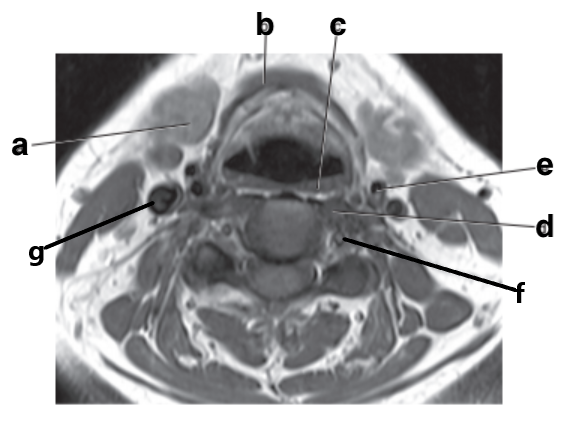 <p>What is letter f?</p>
