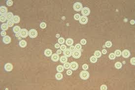 <p>IN BIRD AND BAT DROPPINGS</p><p>INDIA INK PREP</p><p>NIGAR SEED AGAR</p><p></p>