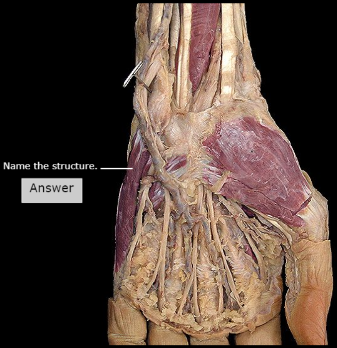 <p>What structure is this?</p>