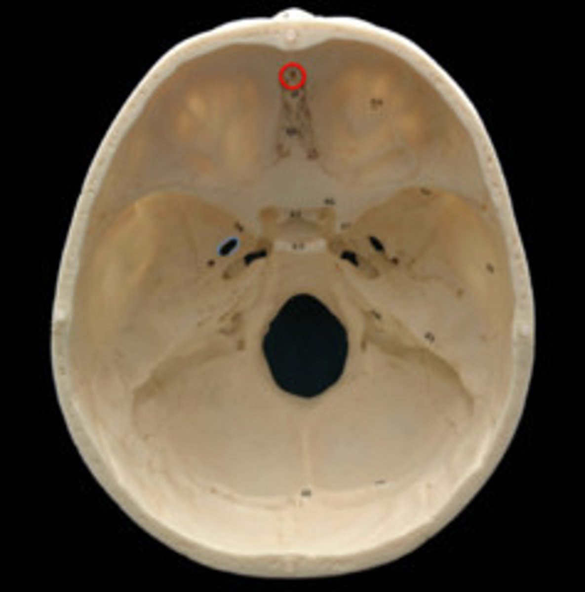 <p>Small pitlike depression located where the sulcus terminalis points backward toward the pharynx.</p>