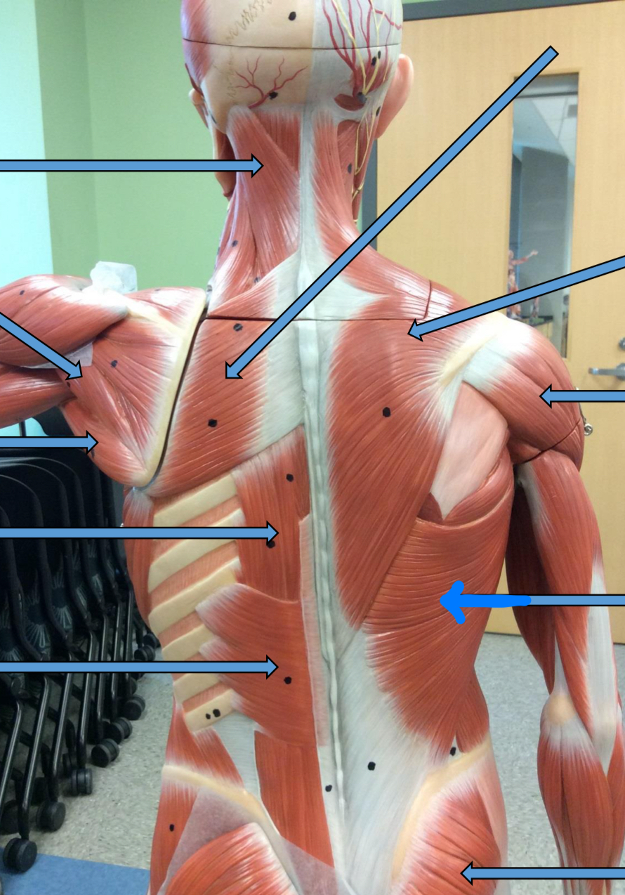 <p>Identify this muscle?</p>