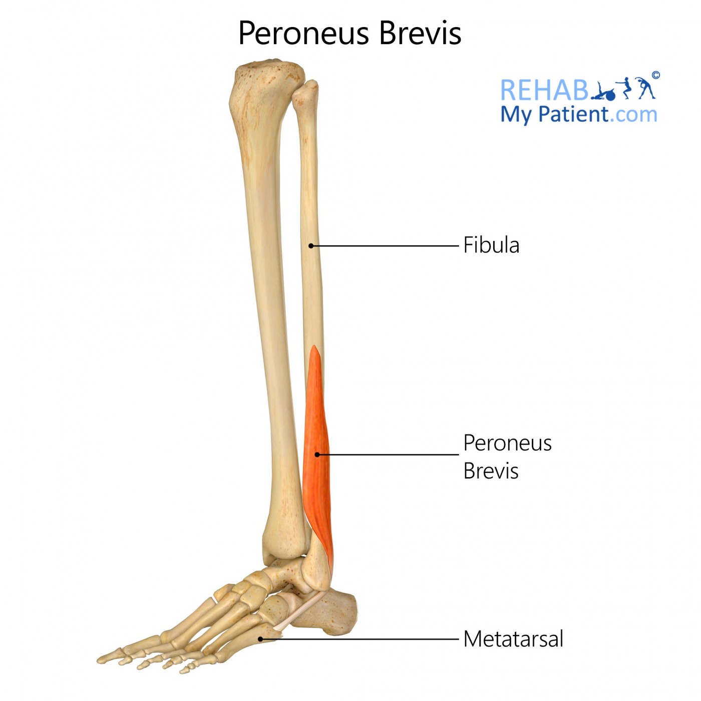 <p>Peroneus Brevis (Fibularis Brevis) Insertion</p>