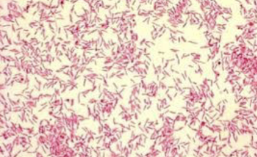 <ul><li><p>Normal flora of mouth and oral cavities</p></li><li><p><strong>Gram negative, fusiform rods</strong></p></li><li><p> Colonies exhibit a characteristic <strong><u>gliding motility</u></strong> on agar</p><ul><li><p> Similar to that of Proteus spp. but not as extensive</p></li></ul></li><li><p>Require increased carbon dioxide for growth</p></li><li><p> Non-hemolytic and produce a yellow-orange pigment</p></li></ul><p></p>