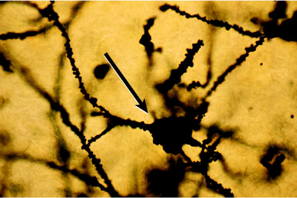<p><strong>NEURON</strong></p>