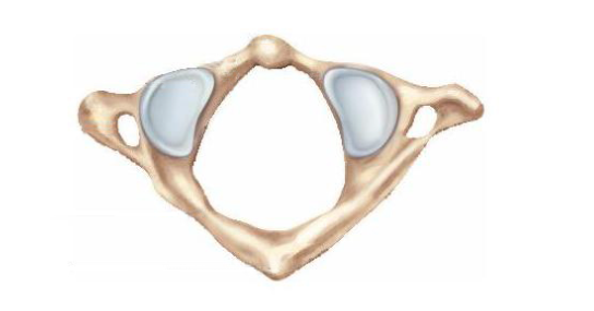 Identify the bone shown in the figure.