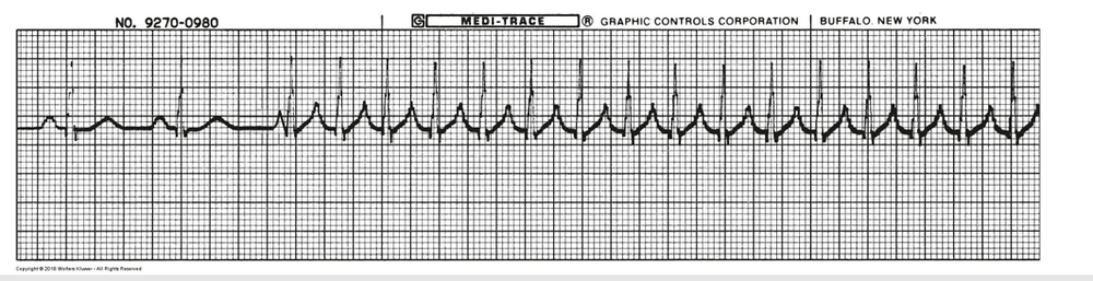What is this rhythm?