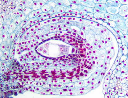 <p>The structure pictured here is a/an:</p><ul><li><p>Embryo sac</p></li><li><p>Cotyledon</p></li><li><p>Pollen grain</p></li><li><p>Aggregate fruit</p></li></ul><p></p>