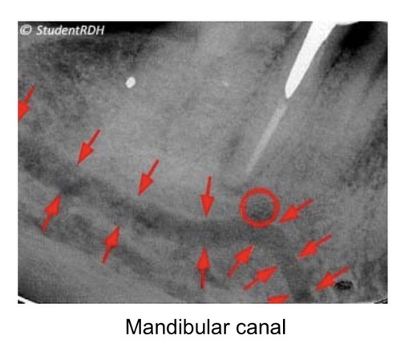 <p>Nerve expands</p>