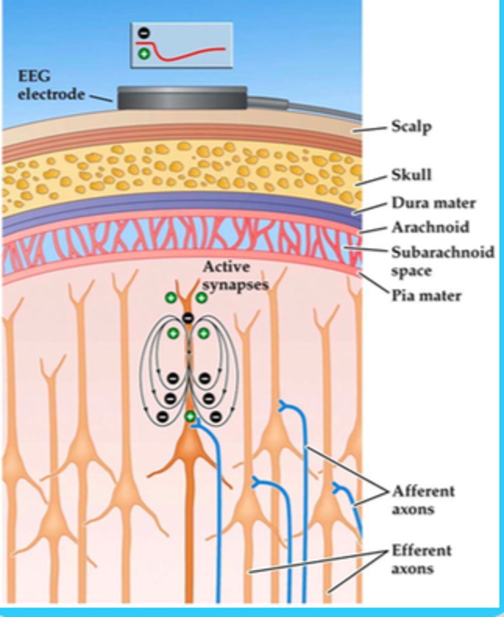 <p>how the neurons are organized</p><p>-this makes it difficult to know where the signal is coming from</p>