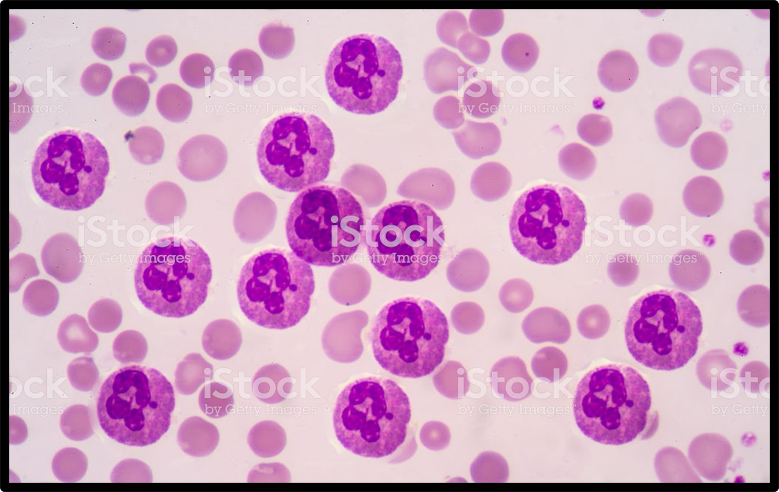 <p>A high Neutrophil count indicates what?</p>