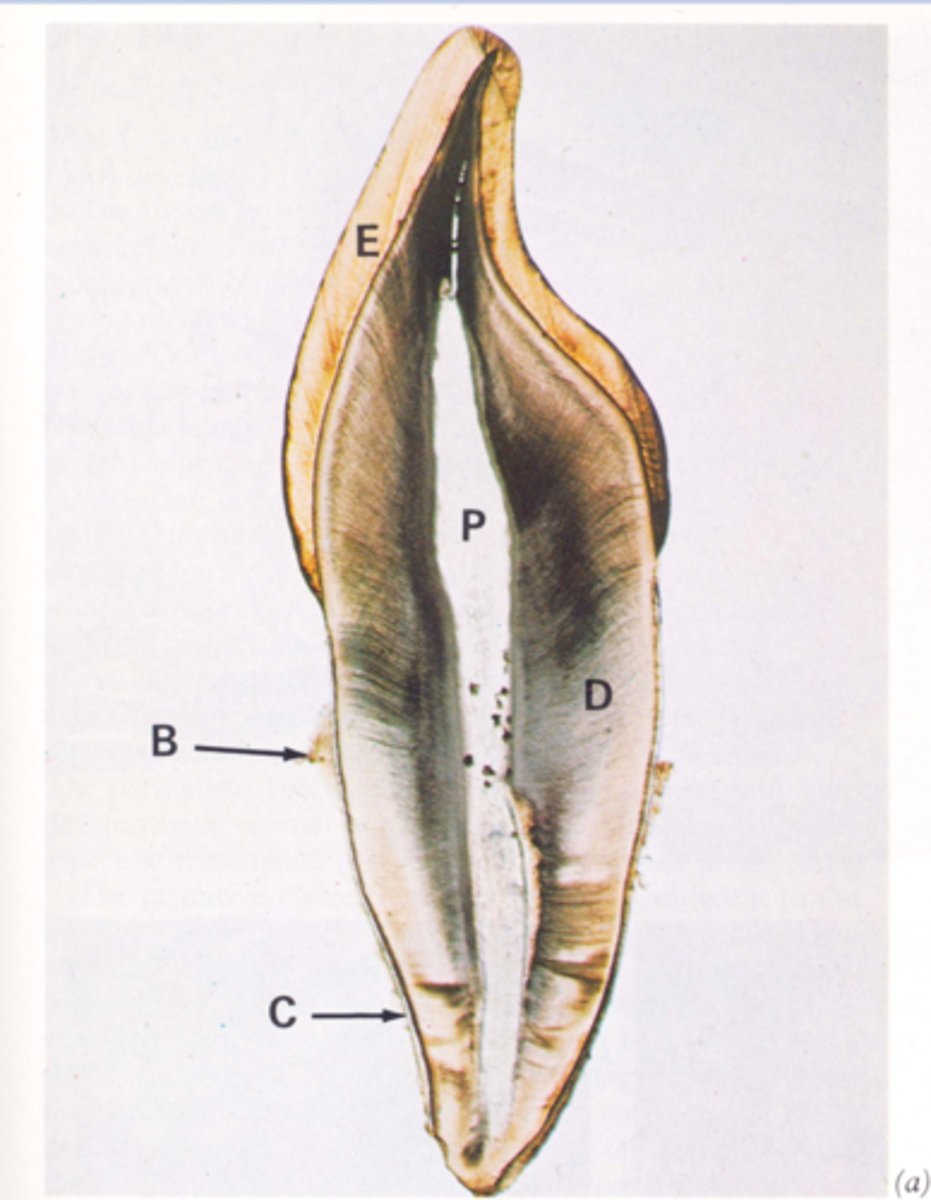 <p>Label this longitudinal section of a simple tooth</p>