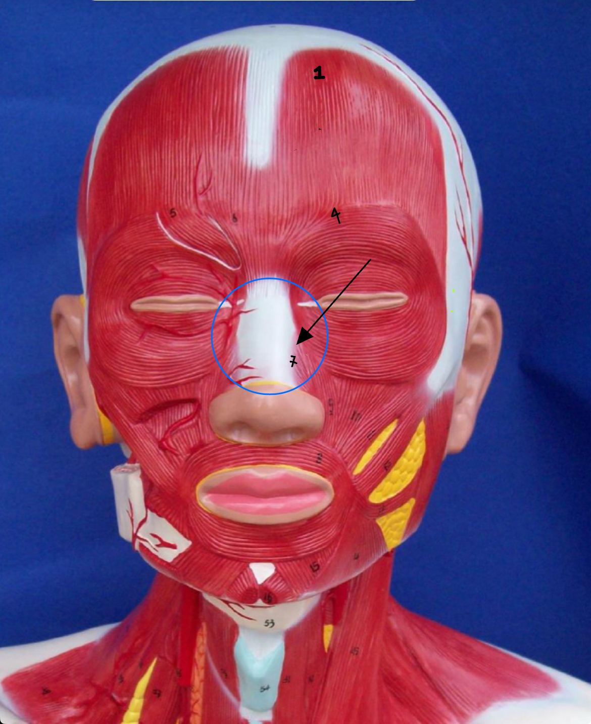<p>what type of muscle is this ( altay model)</p>