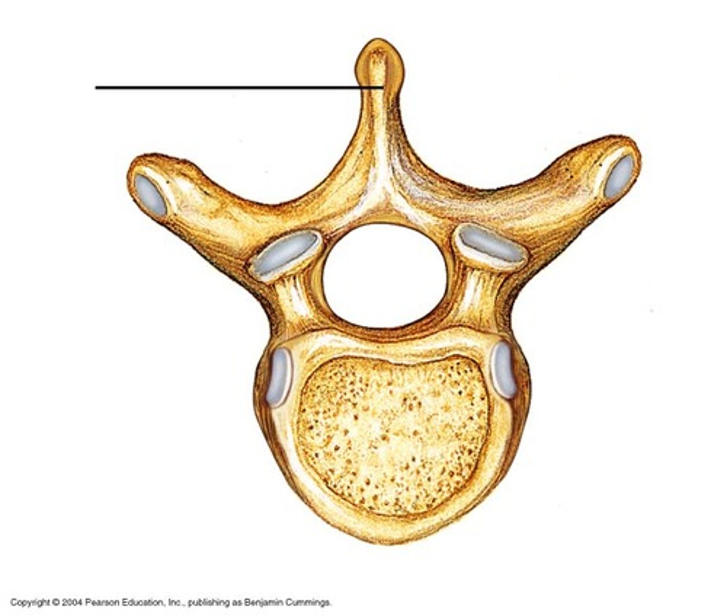 <p>Sharp projection on vertebrae.</p>