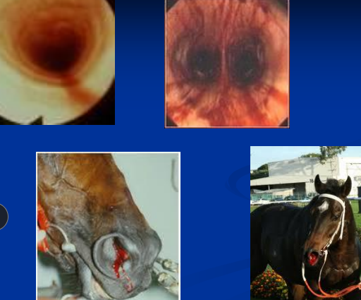 <p><span>Exercise-Induced Pulmonary Hemorrhage</span></p>