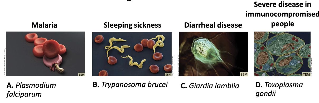 <p>Diseases caused by eukaryal microorganisms:</p><ul><li><p>Protozoa can cause significant <strong><em>human diseases.</em></strong></p></li><li><p>Ex: Malaria, Sleeping sickness, Diarrheal disease, Severe disease in immunocompromised people</p></li></ul><p></p>