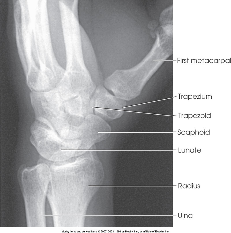 <p>What position is demonstrated?</p>