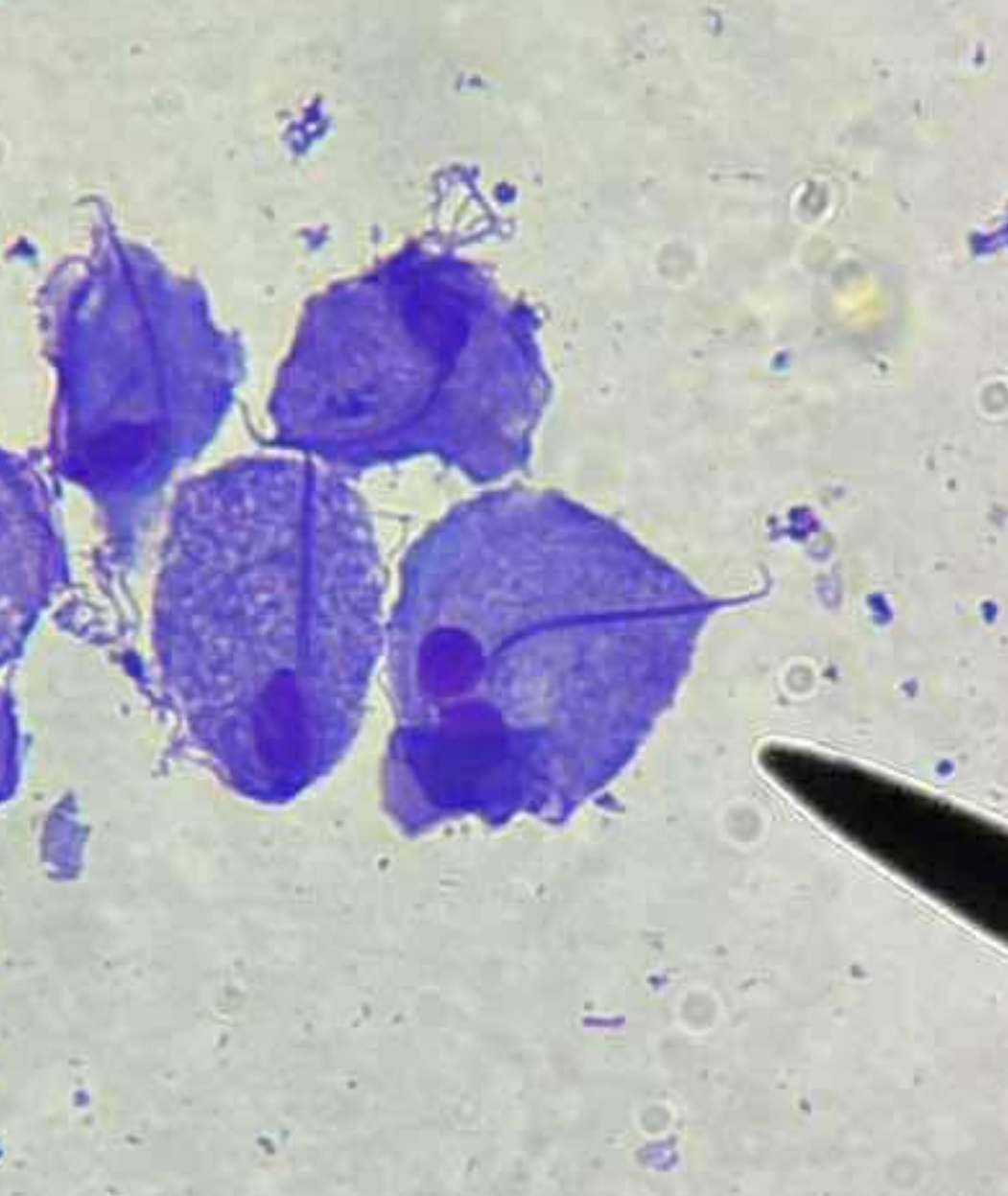 <p>A. identify the organism</p><p>B. what group does this organism belong to</p><p>C. causative agent for:</p>