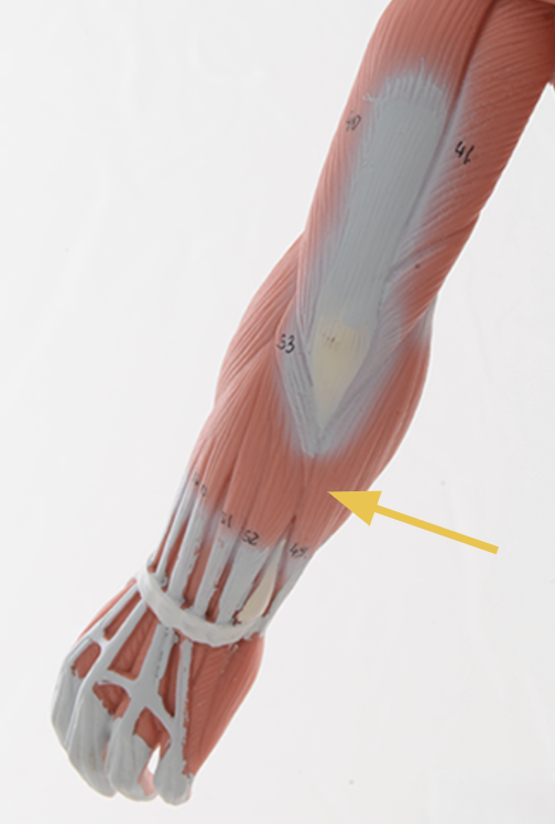 <p>flexor carpi ulnaris m. </p><p>O: medial epicondyle of humerus<br>I: <span>5th metacarpal, hamate and pisifiorm</span><br><span>A: flexion at wrist and ulnar deviation</span><br><span>Inn: ulnar n. </span></p>