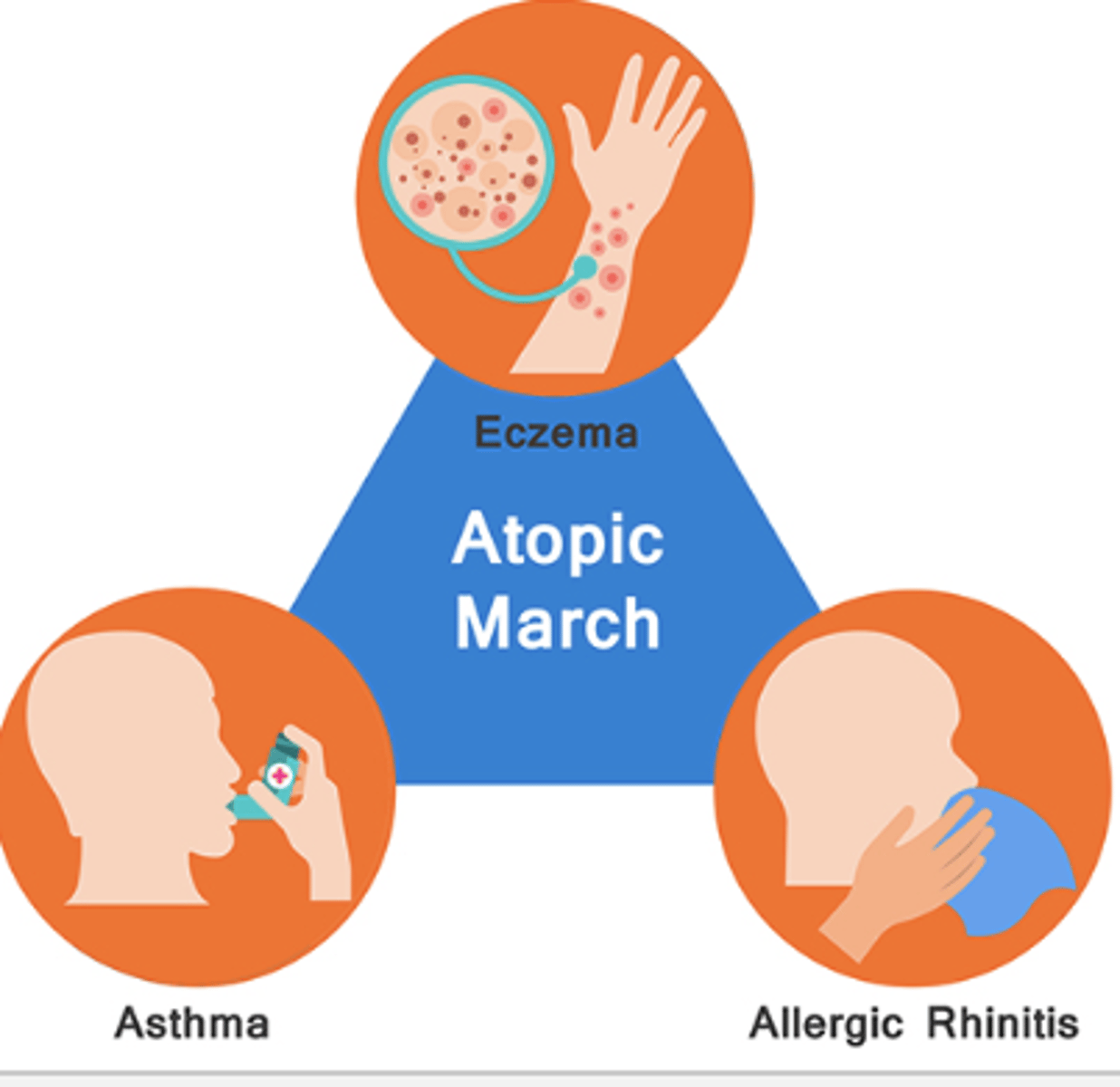 <p>chronic local allergy such as hay fever and asthma</p><p>genetic basis for atopy</p><p>1. increased IgE production</p><p>2. increased reactivity of mast cells</p><p>3. increased susceptibility of target tissue to allergic mediators</p>