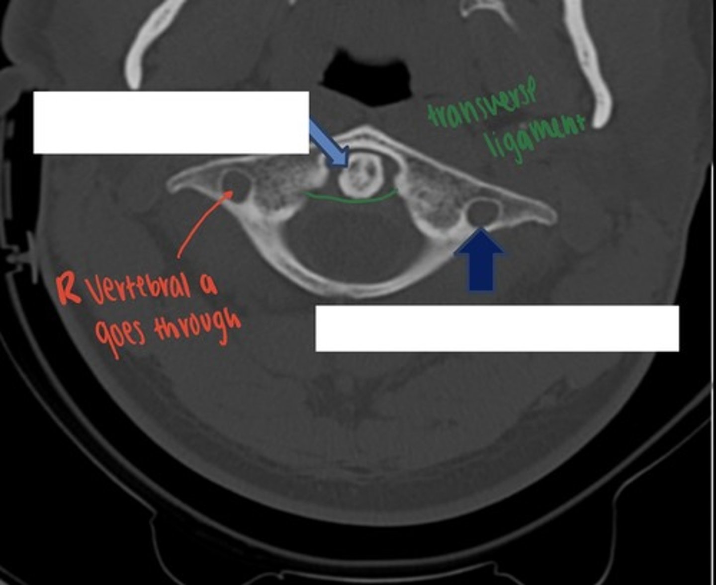 <p>what is the dark blue arrow indicating?</p>
