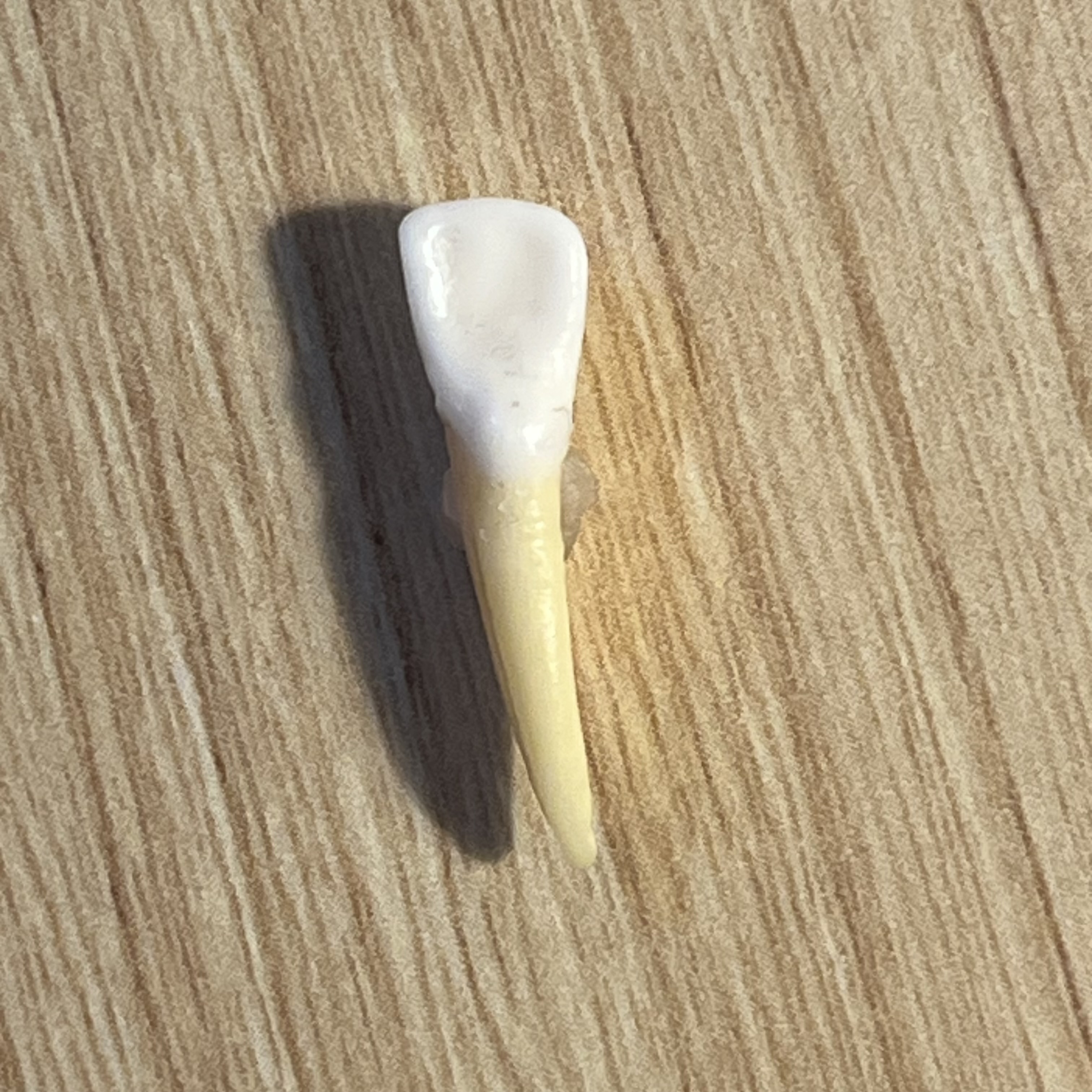 <p>What tooth is this (with view)?</p>