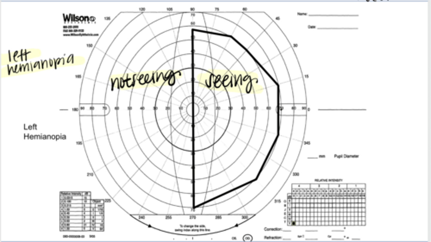 <p>What is the name of this type of defect?</p>
