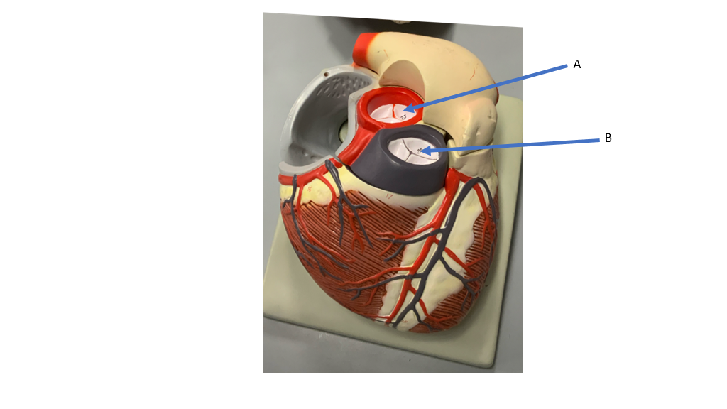 <p>what is A&nbsp;</p>