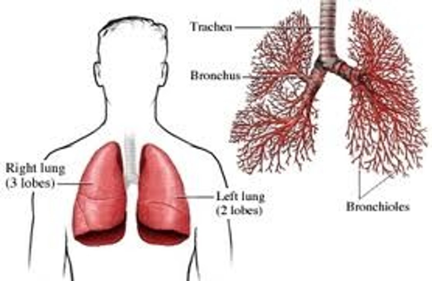 <p>inflammation of the bronchiole</p>