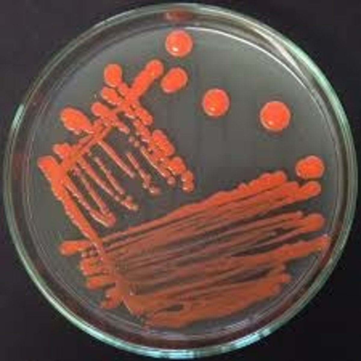 <p>Rhodotorula spp.</p>