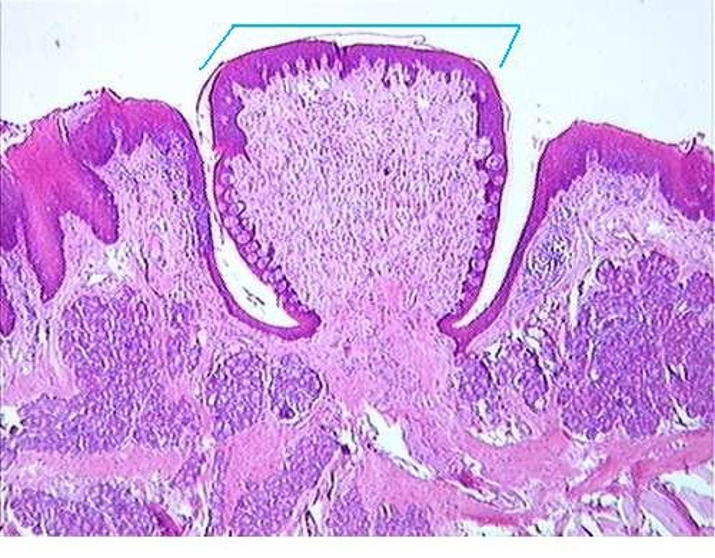 <p>large papillae with taste buds- on back of tongue</p>