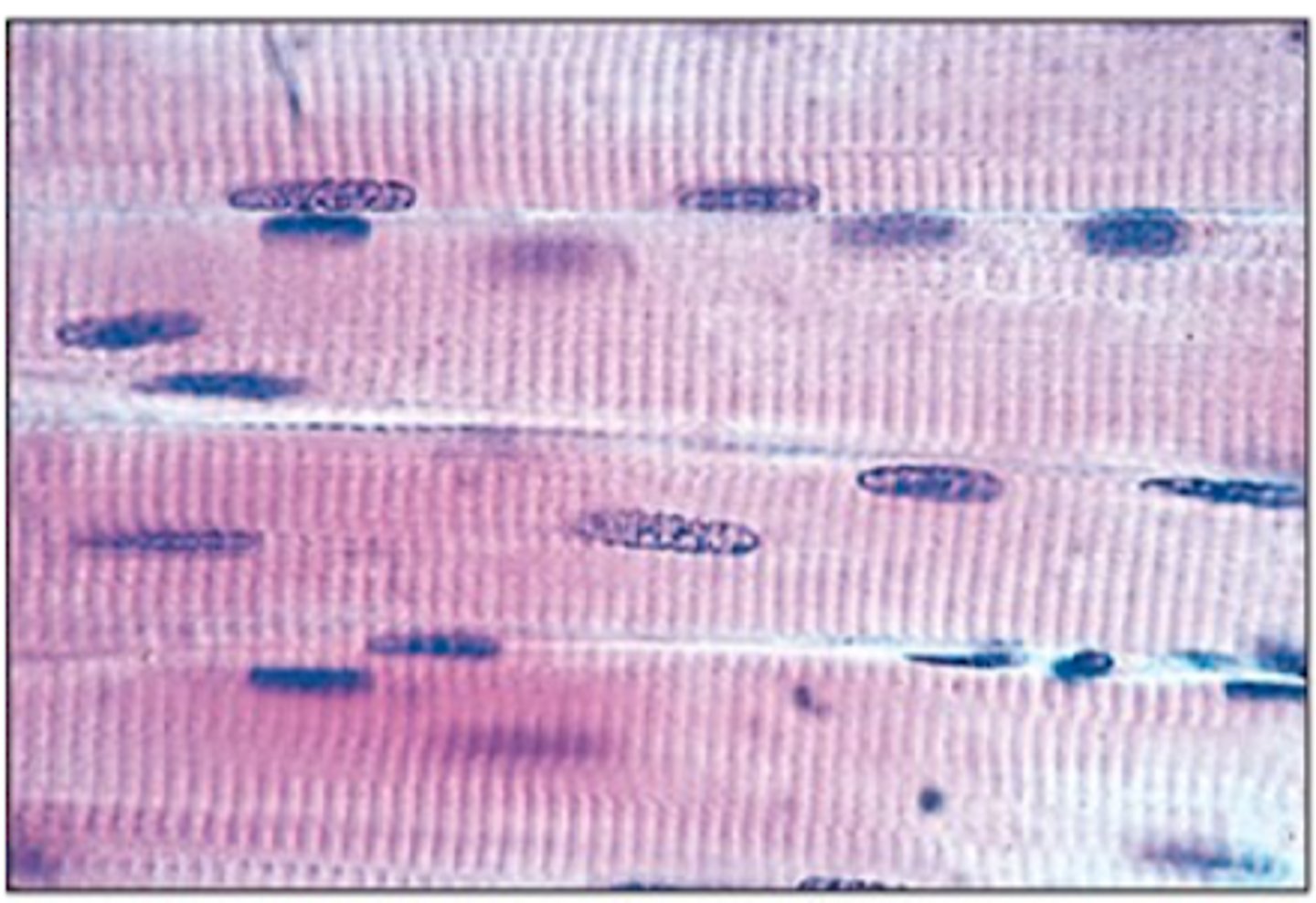 <p>How are the contractions of skeletal muscle?</p>