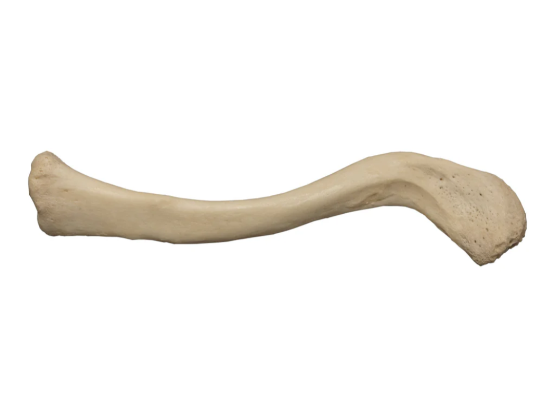 <p>What bone is this? (Appendicular)</p>